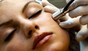 Benefits of Using Facial Microdermabrasion